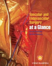 Image of Vascular and Endovascular Surgery at a Glance
