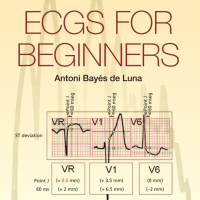 Image of Ecgs For Beginners