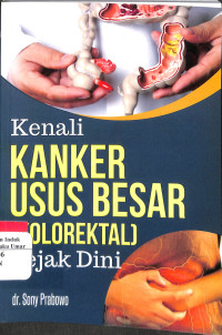 Image of Kenali Kanker Usus Besar 9 Kolorektal) Sejak Dini